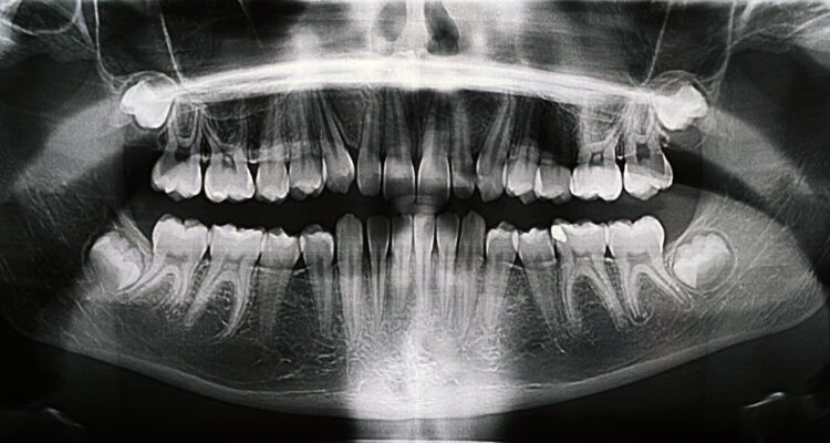 MÁS ALLÁ DE LA SONRISA